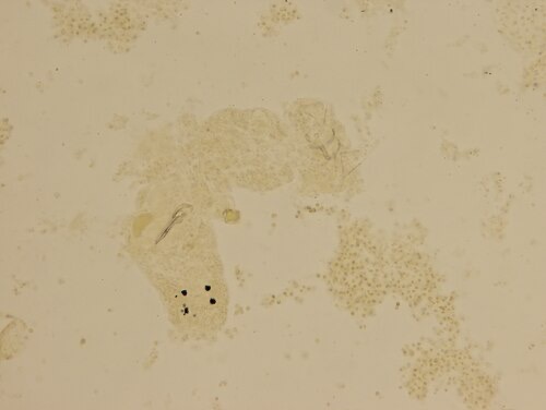 Microscope image: Dactylogyrus vastator, a gill fluke of goldfish relatives. Note the dark eyespots.