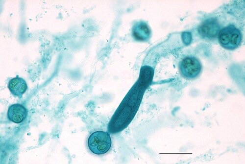 Under a microscope: Saprolegnia threads and spore sacs (stained lab image).