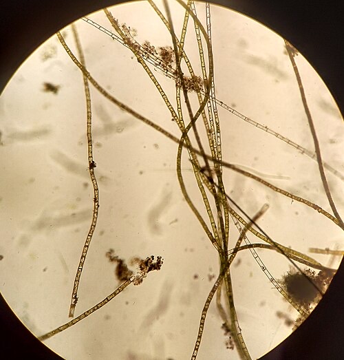 Hair algae under a microscope: each 'hair' is a chain of cells (Oedogonium).