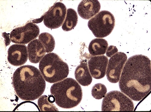 Under a microscope: ich parasites, each with its horseshoe-shaped nucleus (stained lab image).