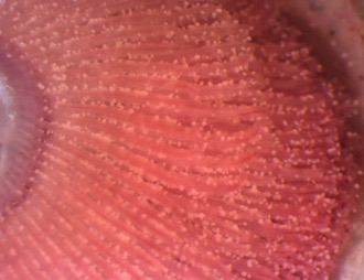 Marine velvet (Amyloodinium) on sea bass gills: each pale dot is a parasite. Same disease family.