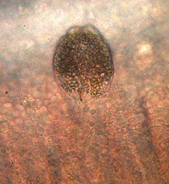 Under a microscope: one velvet parasite anchored to gill tissue (marine Amyloodinium).